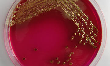 Análisis bacteriológicos